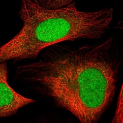 HMGN3/TRIP7 Antibody, Novus Biologicals:Antibodies:Primary Antibodies